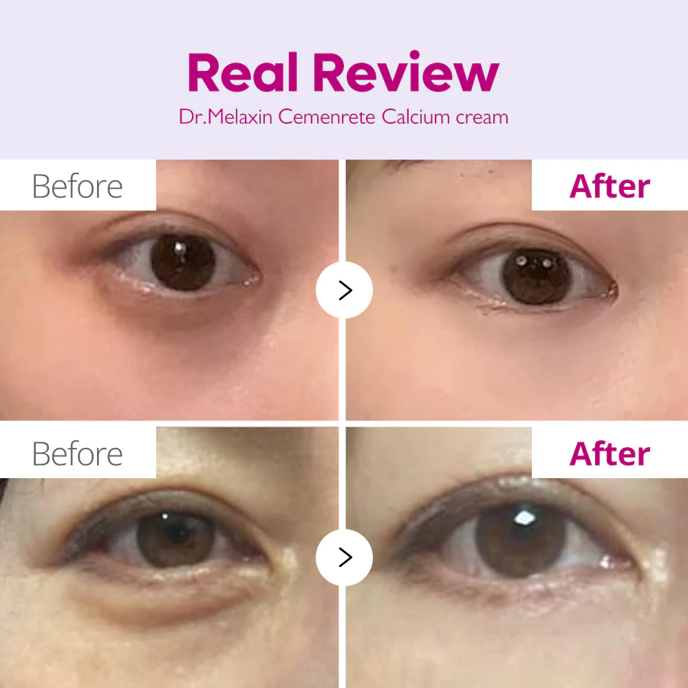 Cemenrete Calcium Intense Cream - Image 5