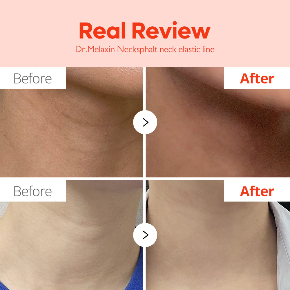 Necksphalt ECM Neck Barrier Ampoule - Image 5