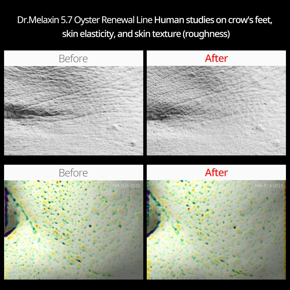 Oyster Pep-3 Renewal Anti-Aging Line - Image 3